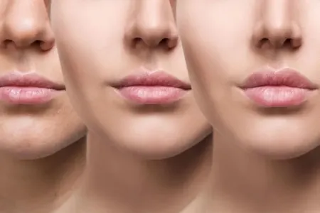 Dodaq balzamından istifadə dodaqlarınıza necə təsir edir?