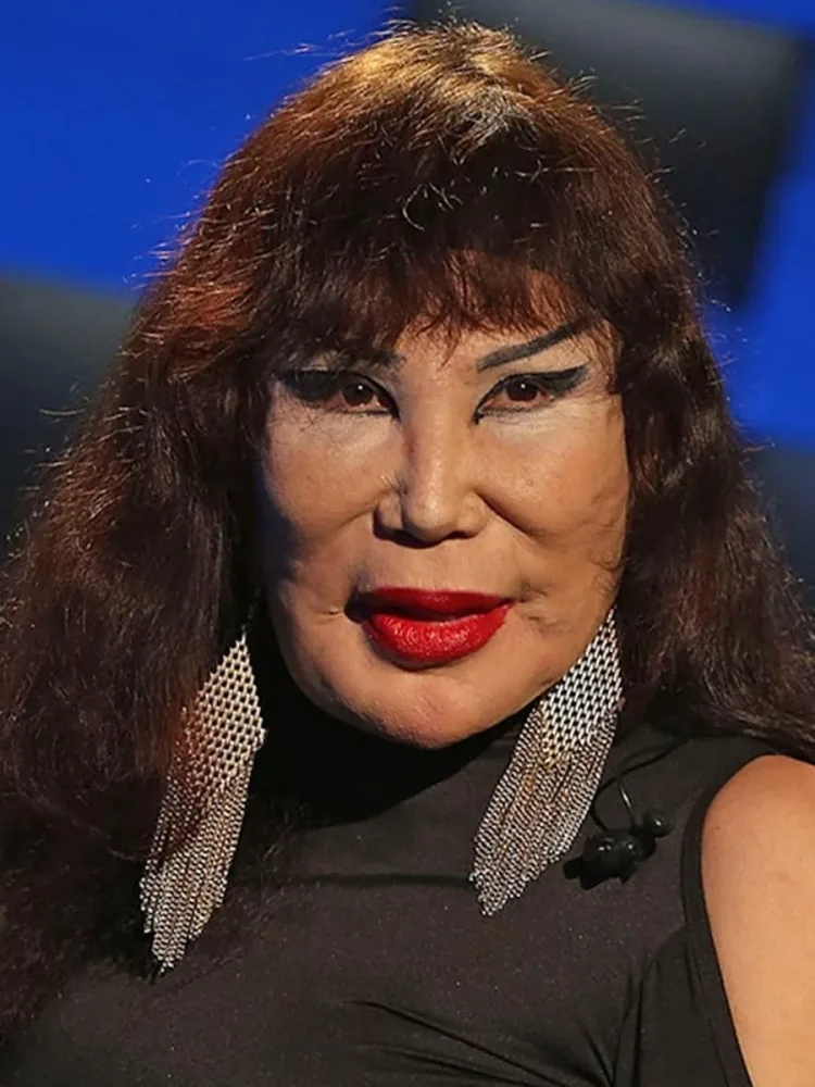 Məşhur aktrisa tanınmaz halda: Üzünə “yemək yağı” vurdurub - FOTO