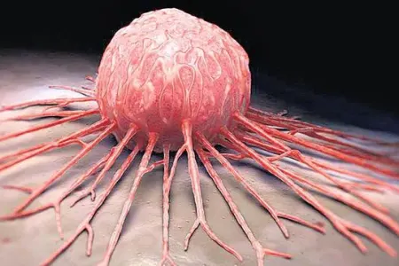 Geni dəyişdirilmiş qidalar xərçəng şişi yaradırmı?