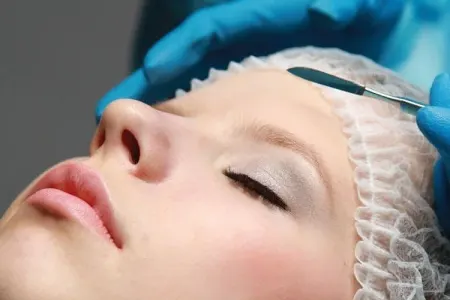 Neçə plastik cərrah nazirliyə sənəd təqdim edib?