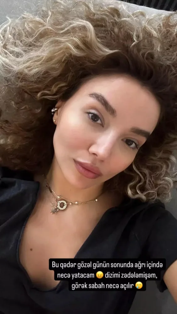 Azərbaycanlı aktrisanın başına İŞ GƏLDİ - FOTO