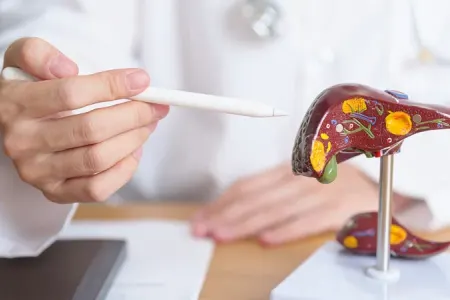 Qaraciyər fibrozunun qeyri-aşkar simptomları açıqlandı