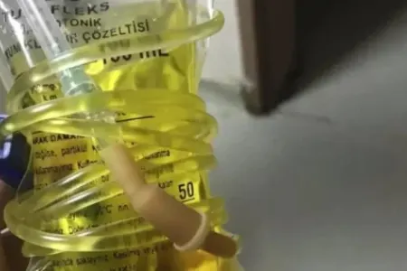 Sarı ölüm - başladı