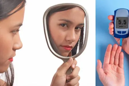 Üzünüz şəkər xəstəliyinin xəbərçisi ola bilər: - Bu əlamətə diqqət
