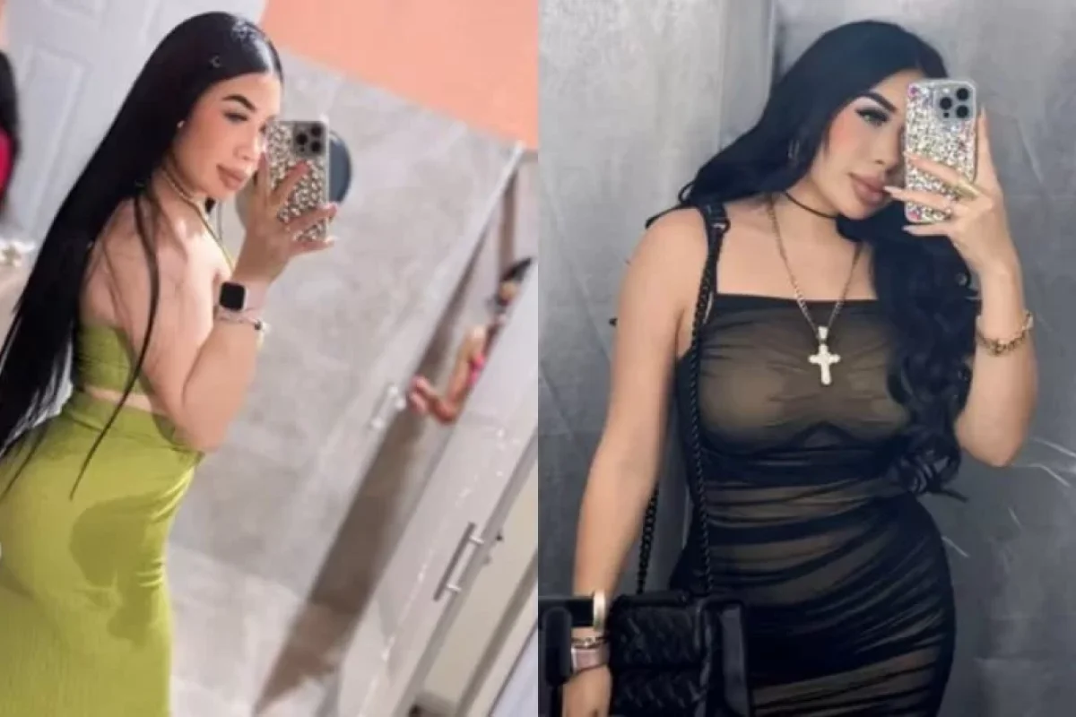 Plastik əməliyyatdan 3 gün sonra - ÖLDÜ