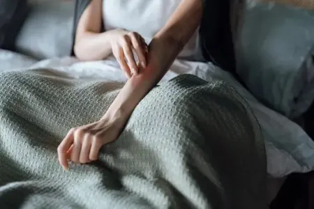 Qaşınmanın səbəbi bu imiş - Alimlər araşdırıb tapdı