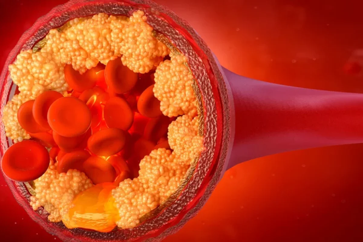 Dietoloq xolesterolu aşağı salan qidaları - açıqladı