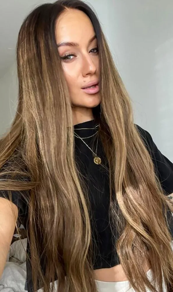 Əməliyyatla sinəsini böyütdü, keçəl qaldı - FOTO