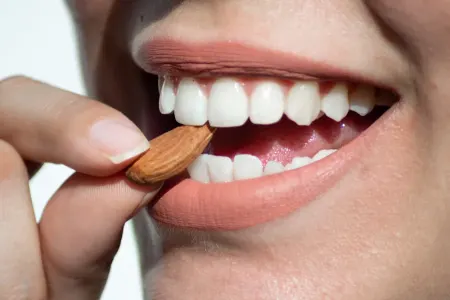 Dişlərin ağardılmasının - hiyləsi