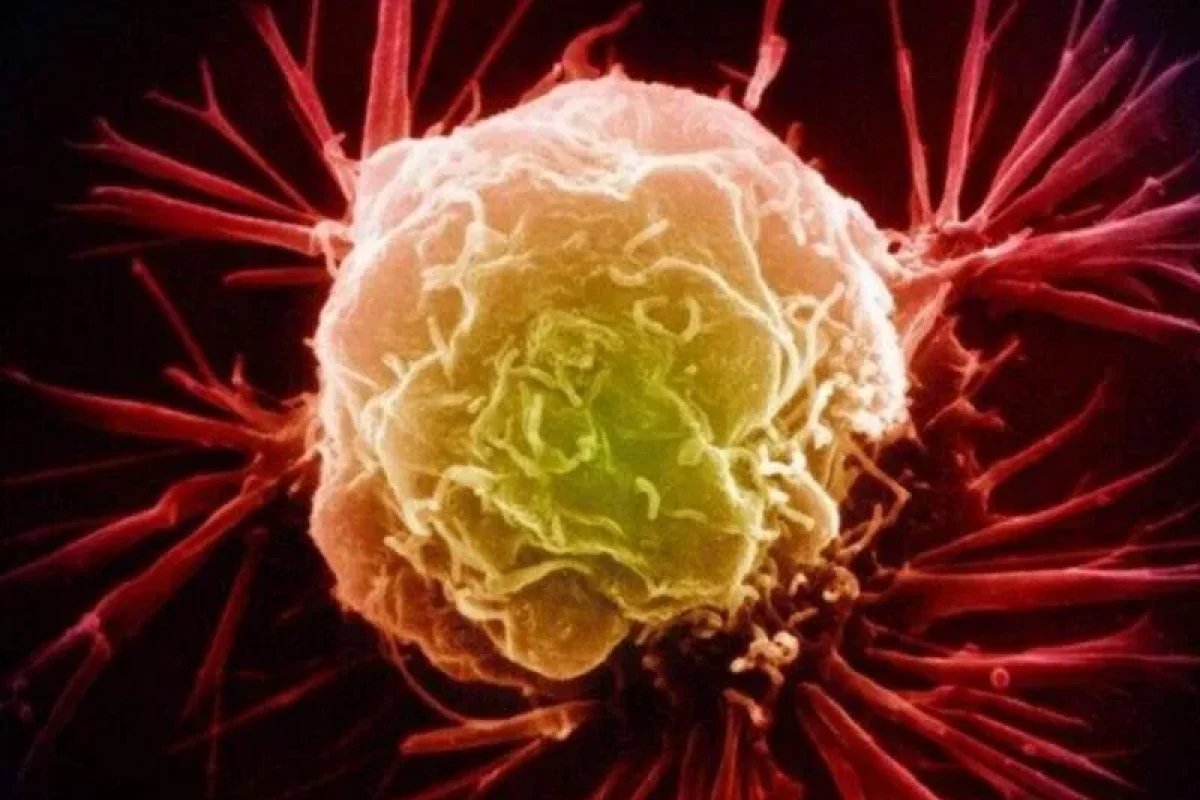 Bizi hər gün öldürən maddələr: - xərçəng yaradır