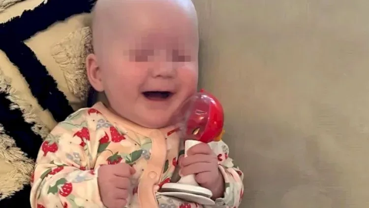 Gözsüz körpə doğuldu - FOTO