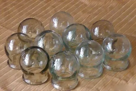 Uşaqlara banka qoymaq olarmı? - Həkim açıqladı - VİDEO