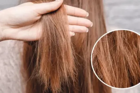 Saçların təbii xilaskarı! - Həftədə iki dəfə tətbiq edin