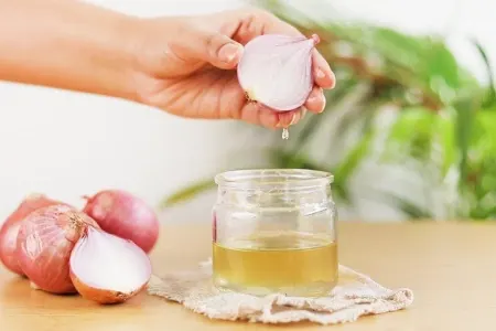 Yeni saçlar çıxardır, uzadır... - Hər evdə var