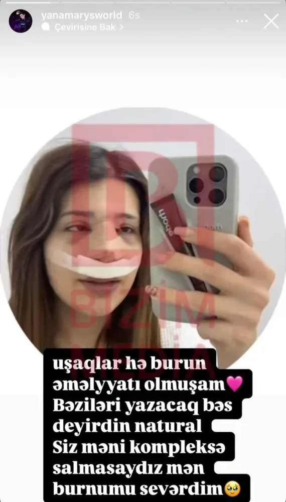 Rəqsanənin kiçik qızı əməliyyat olundu