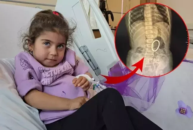 Qarnı ağrıyan 4 yaşlı uşağın bağırsağından görün nələr çıxdı - FOTO