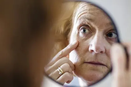 Həkim erkən qırışların səbəblərini açıqladı