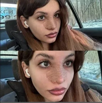 Rəqsanənin qızı Yağmur TAMAMİLƏ DƏYİŞDİ - – FOTOLAR