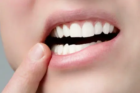 Şirniyyatdan sonra dişlərinizi fırçalamayın