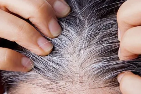 Ağ saçlara son qoyan möcüzəvi tərəvəz