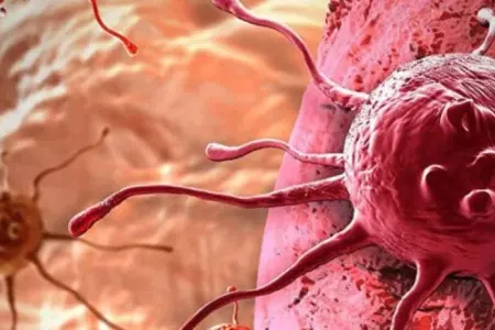 Bu vitamin xərçəngi 10 günə öldürür