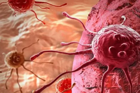 Bağırsaq xərçənginin qarşısını alan - MƏHSUL