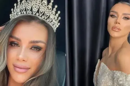 Məşhur modelin üstündən maşın keçdi