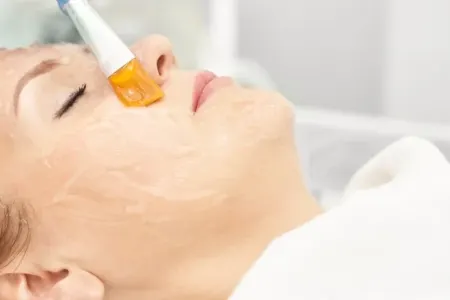 Yalnız bir səhvlə üzünüzü korlaya bilərsiniz - AÇIQLAMA