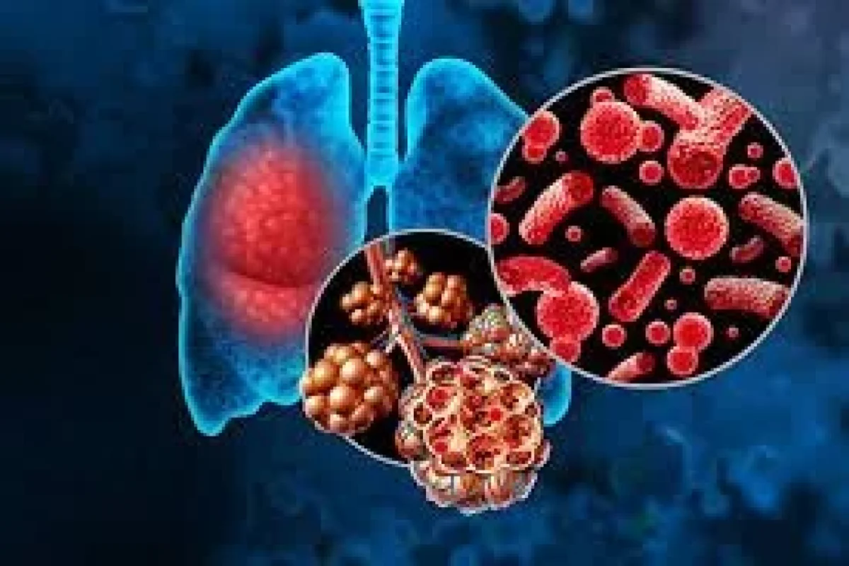 Qanlı öskürəyə səbəb olan təzə virus açıqlandı