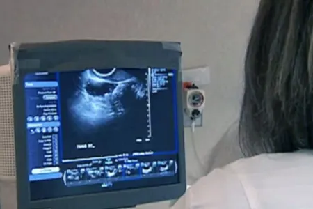 Xərçəngin yayılmasını dayandıran zülal tapıldı