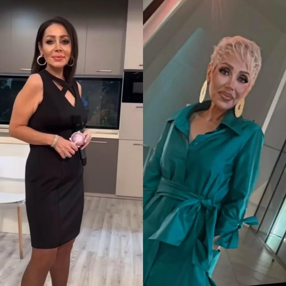 Emma Ələkbərzadə tanınmaz halda - FOTO