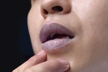 Dodaqlar niyə - GÖYƏRİR?