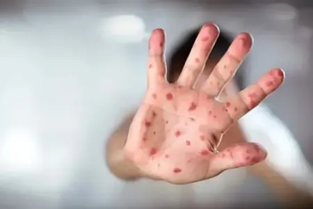 Dəhşətli hadisə: