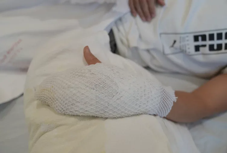 Buz barmağını - yandırdı