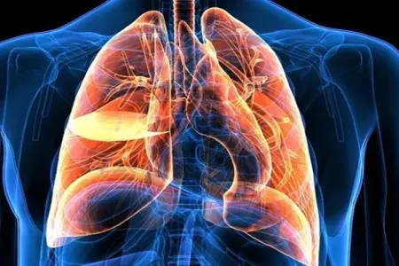 Ağciyər xərçənginin 12 əlaməti