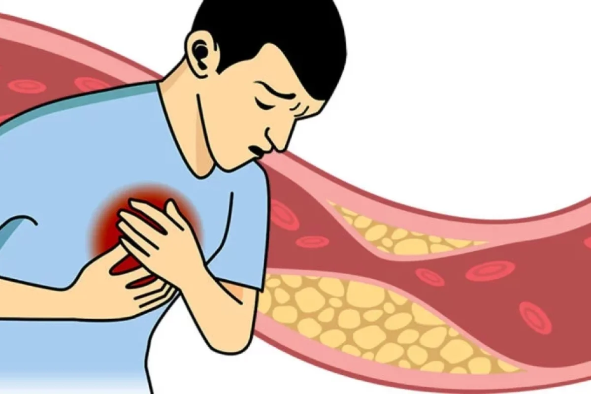 Sağlamlıq üçün yediyimiz bu QİDALAR - xolesterolu YÜKSƏLDİR