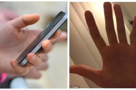 Smartfon çəçələ barmağın düşmənidir