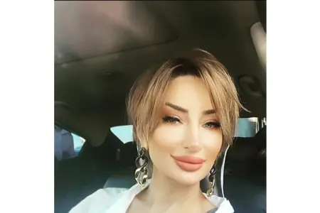 Aynur Rüstəmova vəfat etdi