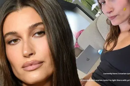 Heyli Biberin xəstəliyi nədir?