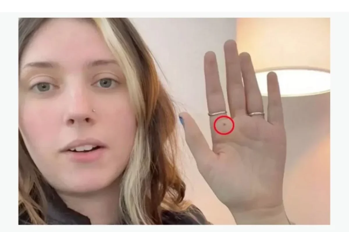 "ChatGPT" qadına fotodan əlini analiz etdikdən sonra təcili olaraq xəstəxanaya getməyi tövsiyə etdi