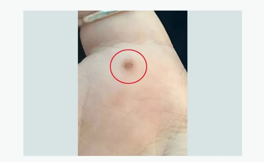 "ChatGPT" qadına fotodan əlini analiz etdikdən sonra təcili olaraq xəstəxanaya getməyi tövsiyə etdi