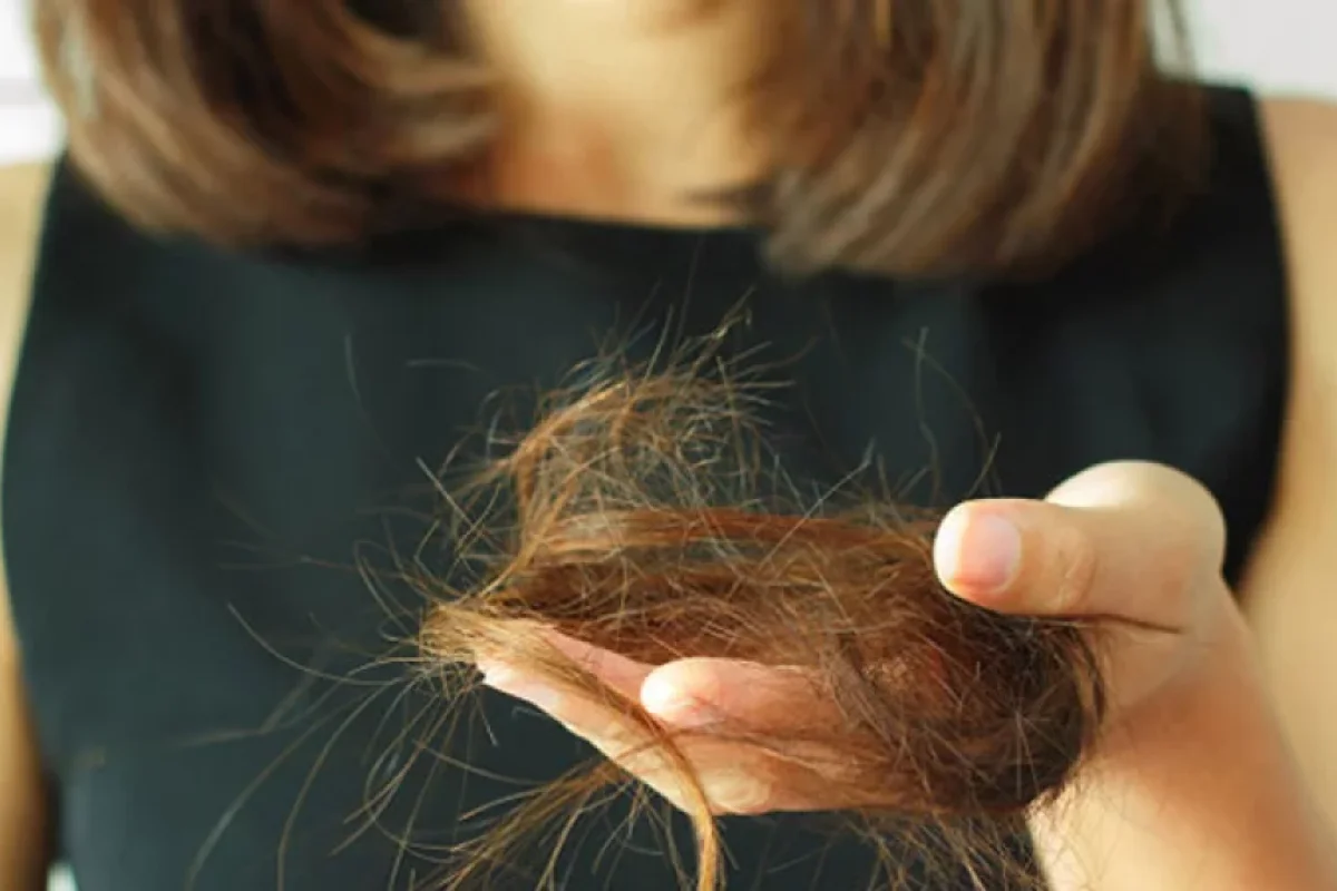 Yaz fəslində saç tökülməsi artır - Səbəb nədir?