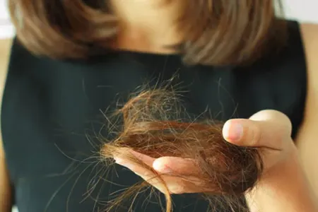 Yaz fəslində saç tökülməsi artır - Səbəb nədir?