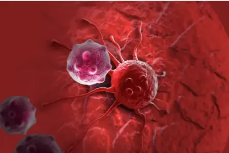 Piylənmə və köklüyün xərçənglə birbaşa əlaqəsi - sübut olundu