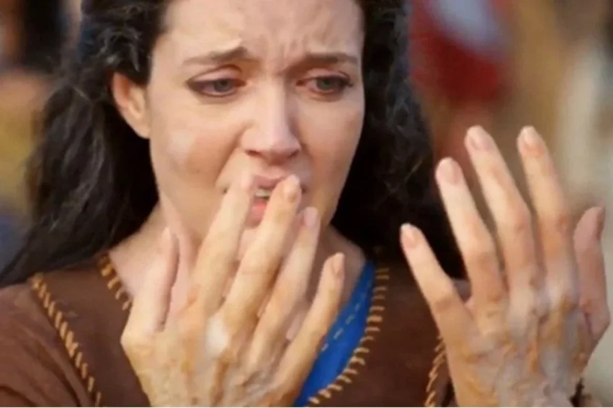 Azərbaycanda neçə cüzam xəstəsi var? - RƏSMİ