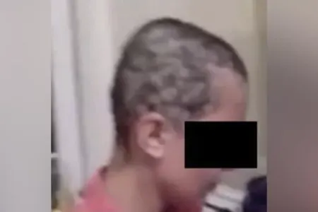 Azərbaycanda sevgilisinin saçını qırxan kişi həbs edildi