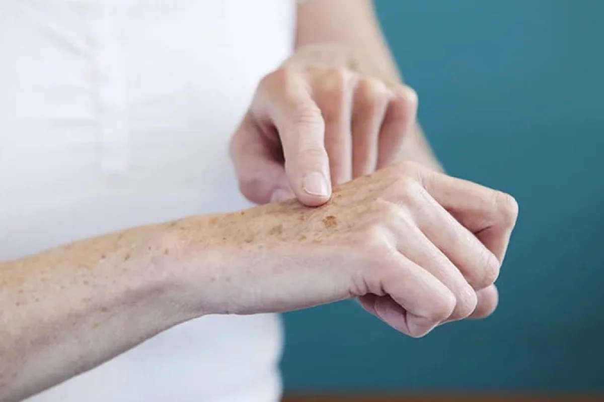 Əllərdə ləkələrin yaranmasına səbəb nədir?