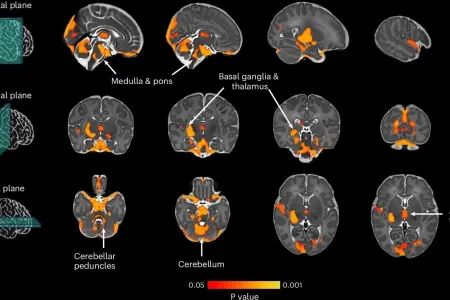 Körpənizin ilk addımları DNT-də yazılıb