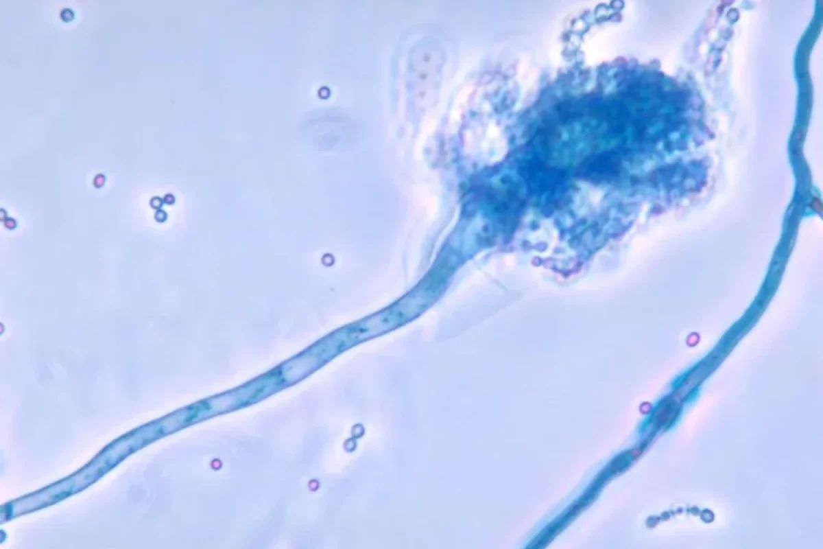 Qlobal istiləşmə ölümcül göbələk xəstəliyini yaya bilər