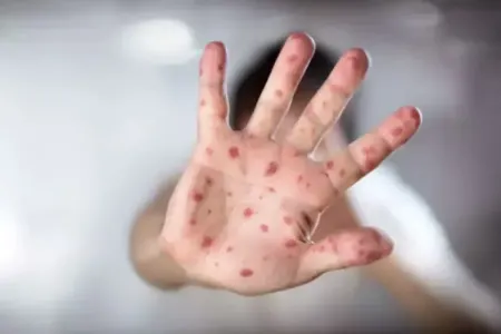 Qızılca geri döndü